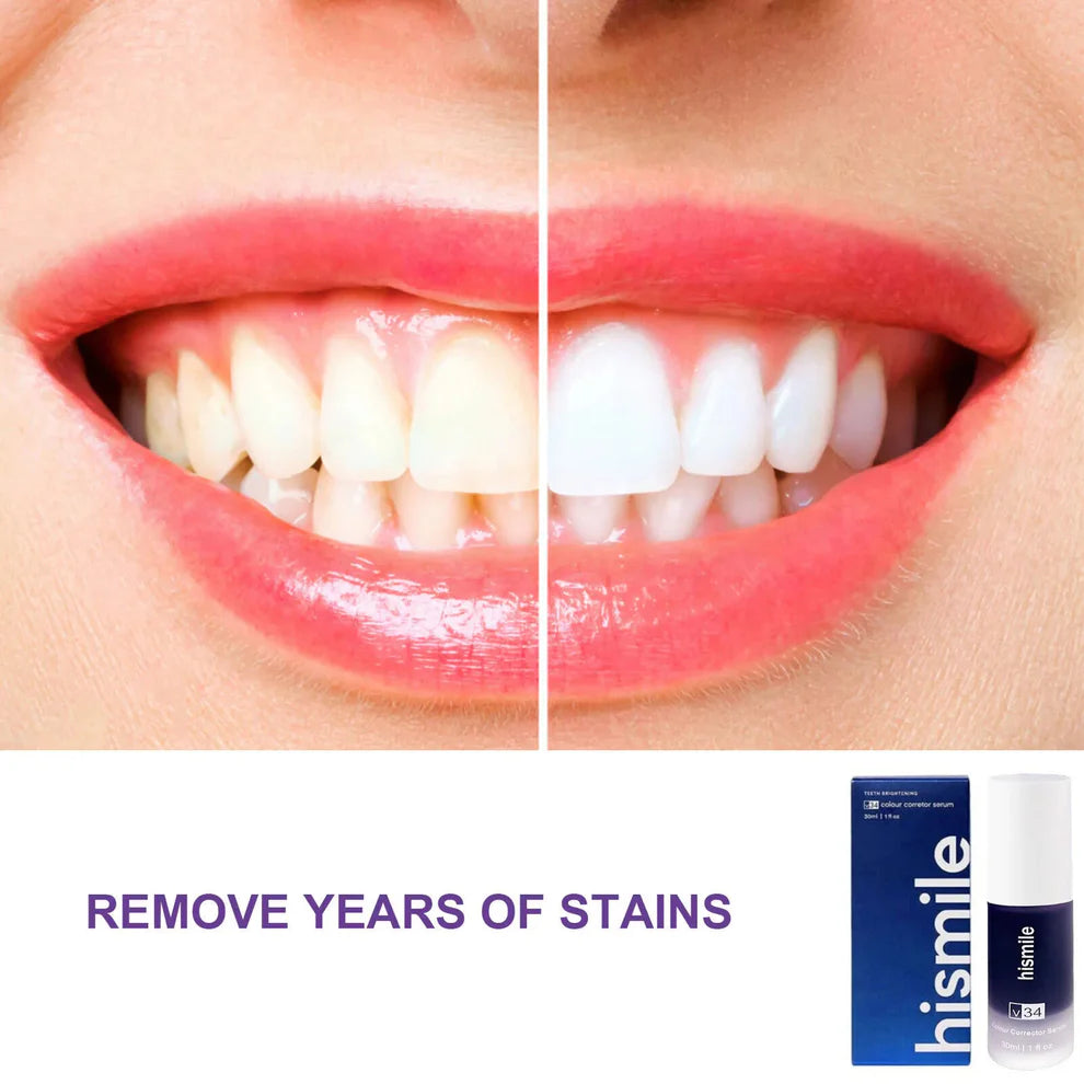Hismile V34 Violet Toothpaste – Brighten Instantly, Shine Effortlessly