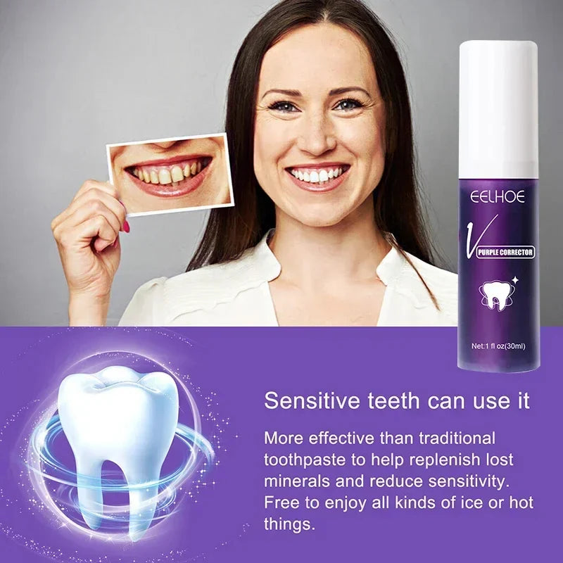 Hismile V34 Violet Toothpaste – Brighten Instantly, Shine Effortlessly